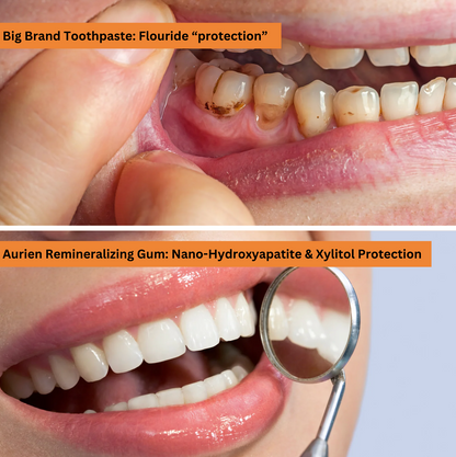 1 Pack Remineralizing Gum + $20 Gift Card